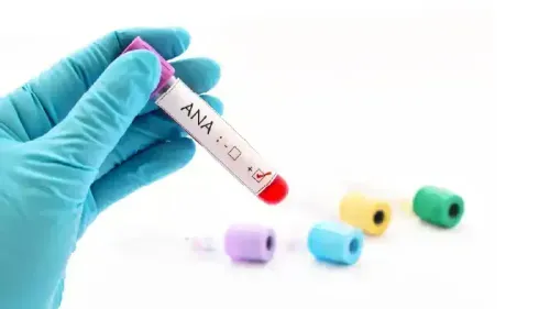 What Diseases Can Cause a Positive ANA?